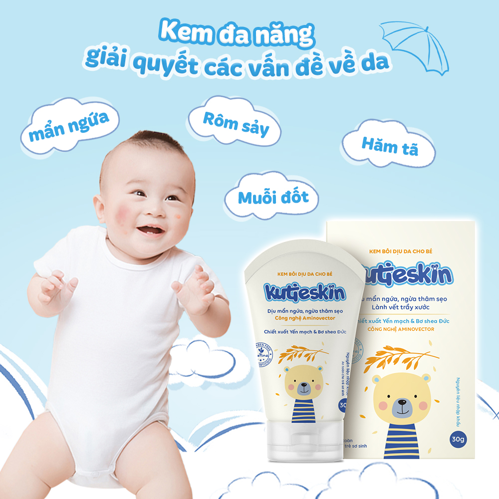 Kutieskin 30gr - Kem mẩn ngứa – hăm  ( muỗi đốt côn trùng cắn)
