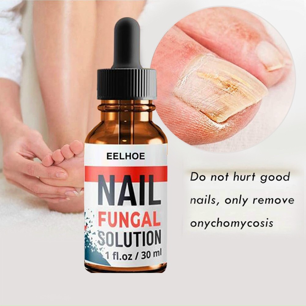 Serum trị nấm móng dưỡng móng phục hồi móng hư tổn