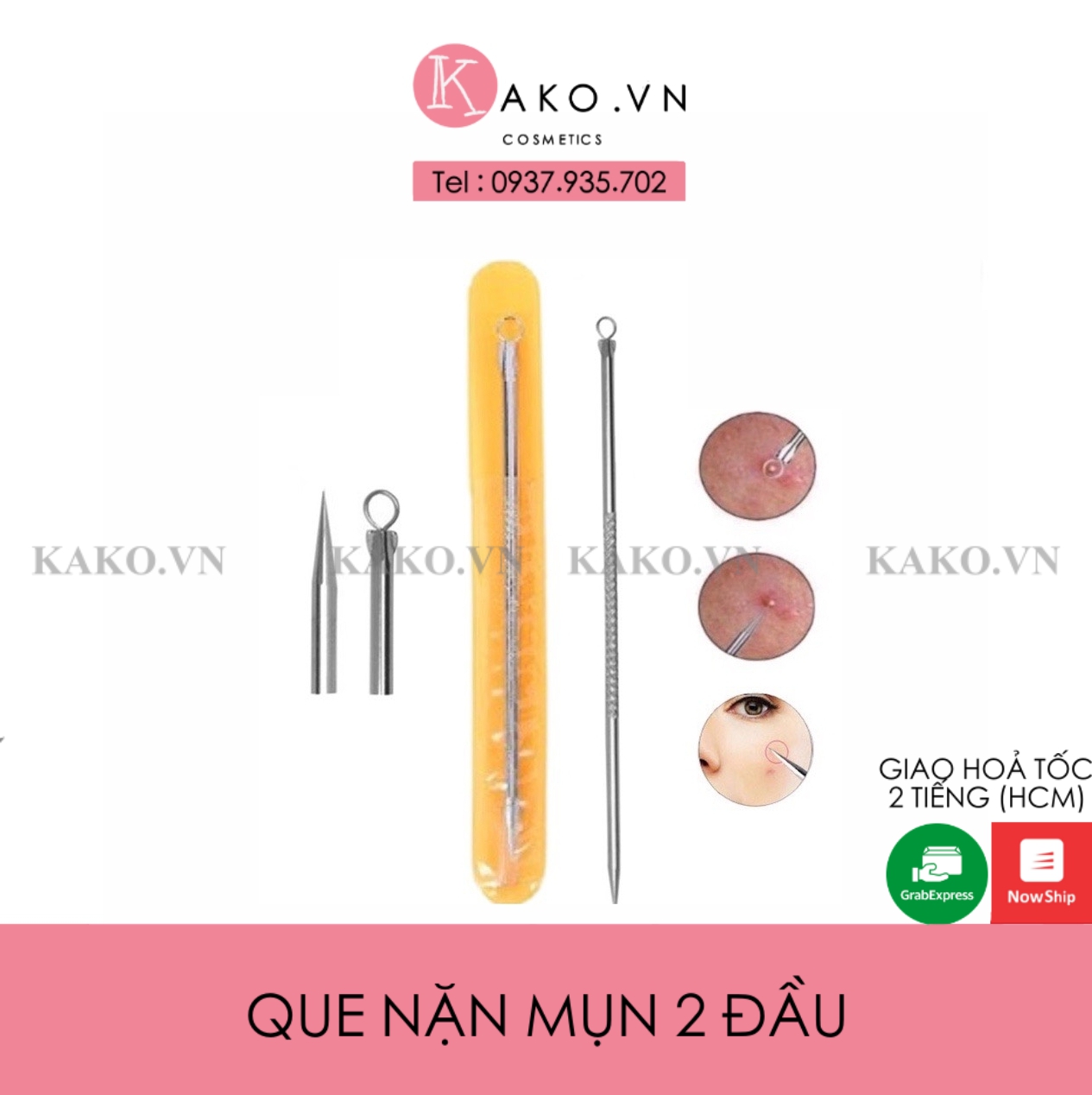 Cây nặn mụn Ance Control 2 đầu - que nặn mụn đầu đen, mụn cám