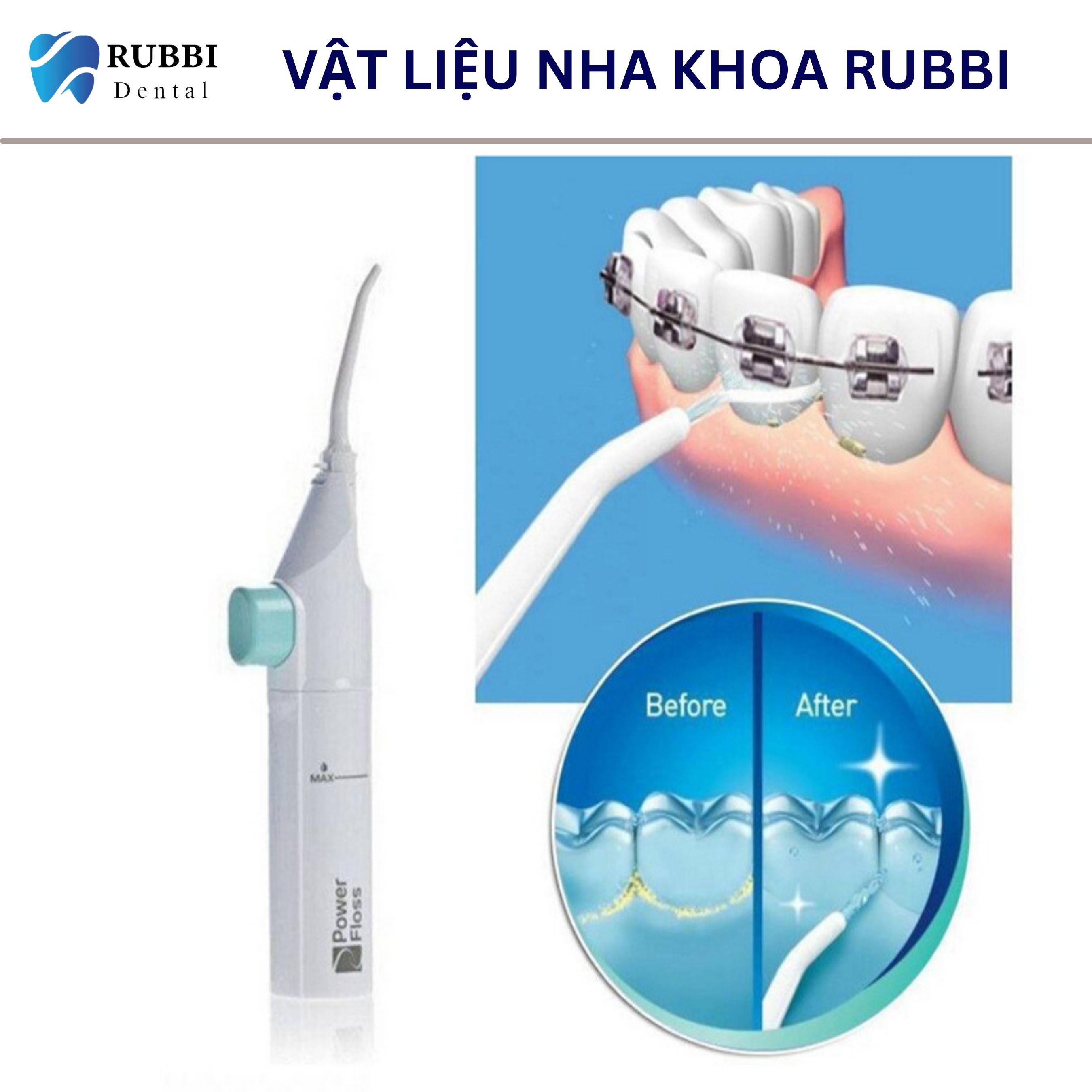 Máy tăm nước cơ, vệ sinh răng miệng Power Floss