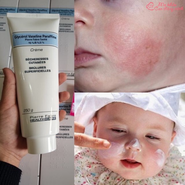 Kem dưỡng da chữa nẻ, chàm Dexeryl 250g Pháp - Beautify skin