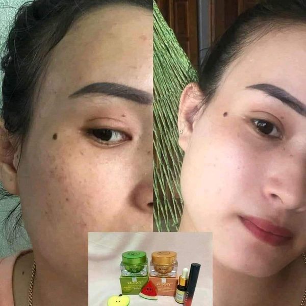 Kem Zenny Chính Hãng Ban Đêm