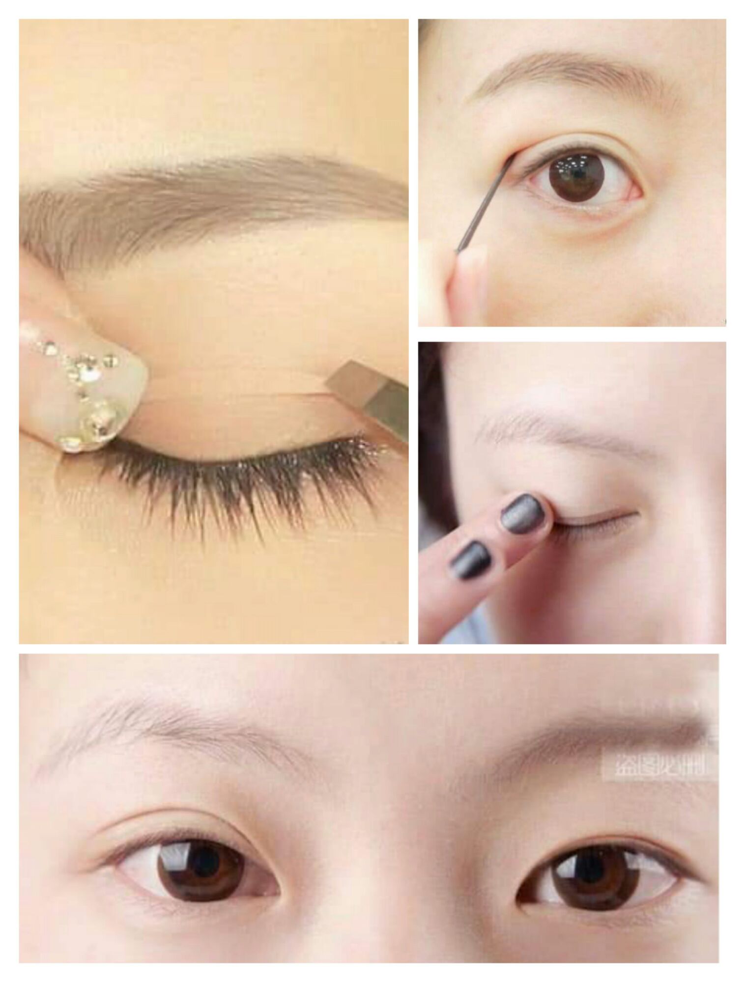 Kích mí lưới không cần keo