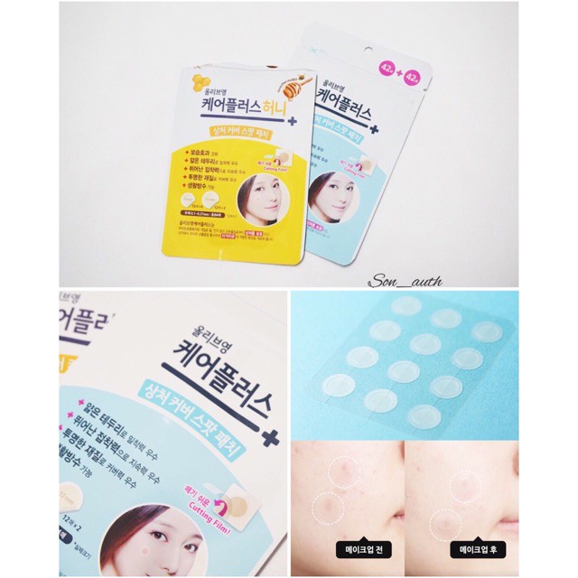 Miếng dán mụn Careplus của Olive Young