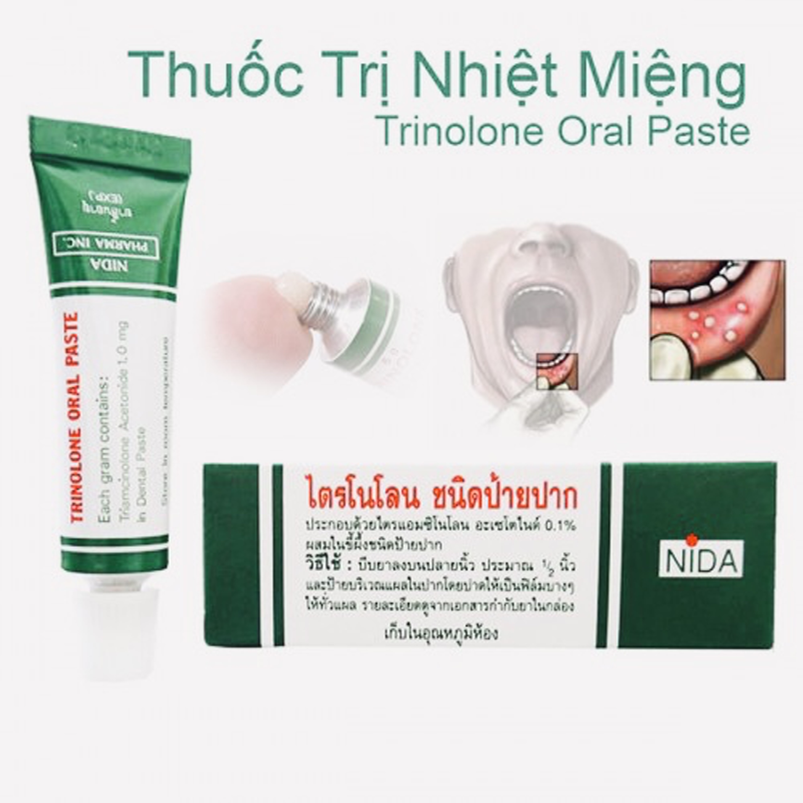 [HCM]Kem bôi nhiệt miệng Trinolone Oral Paste THÁI LAN