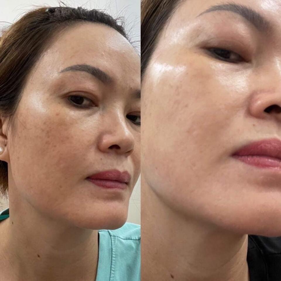 Cao Nám Insam Dr Cell 20g mờ thâm nám tàn nhang trắng da trẻ hoá da