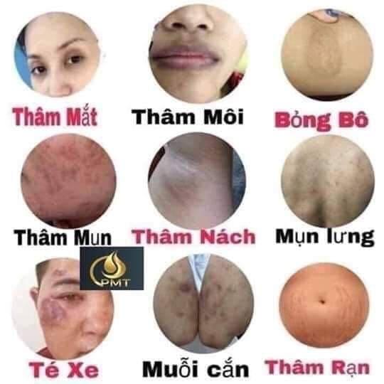 [Chính Hãng] SERUM SẠCH THÂM - MỜ NÁM PHÚC MINH TÂM