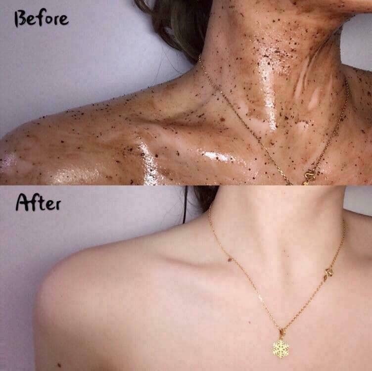 (Mẫu mới) Tẩy Da Chết Body Quế Hồi Nga