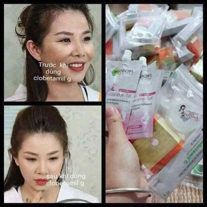 1 set Garnier Tem Vàng Chuẩn Thái Lan [Loại 1] gồm 5 món