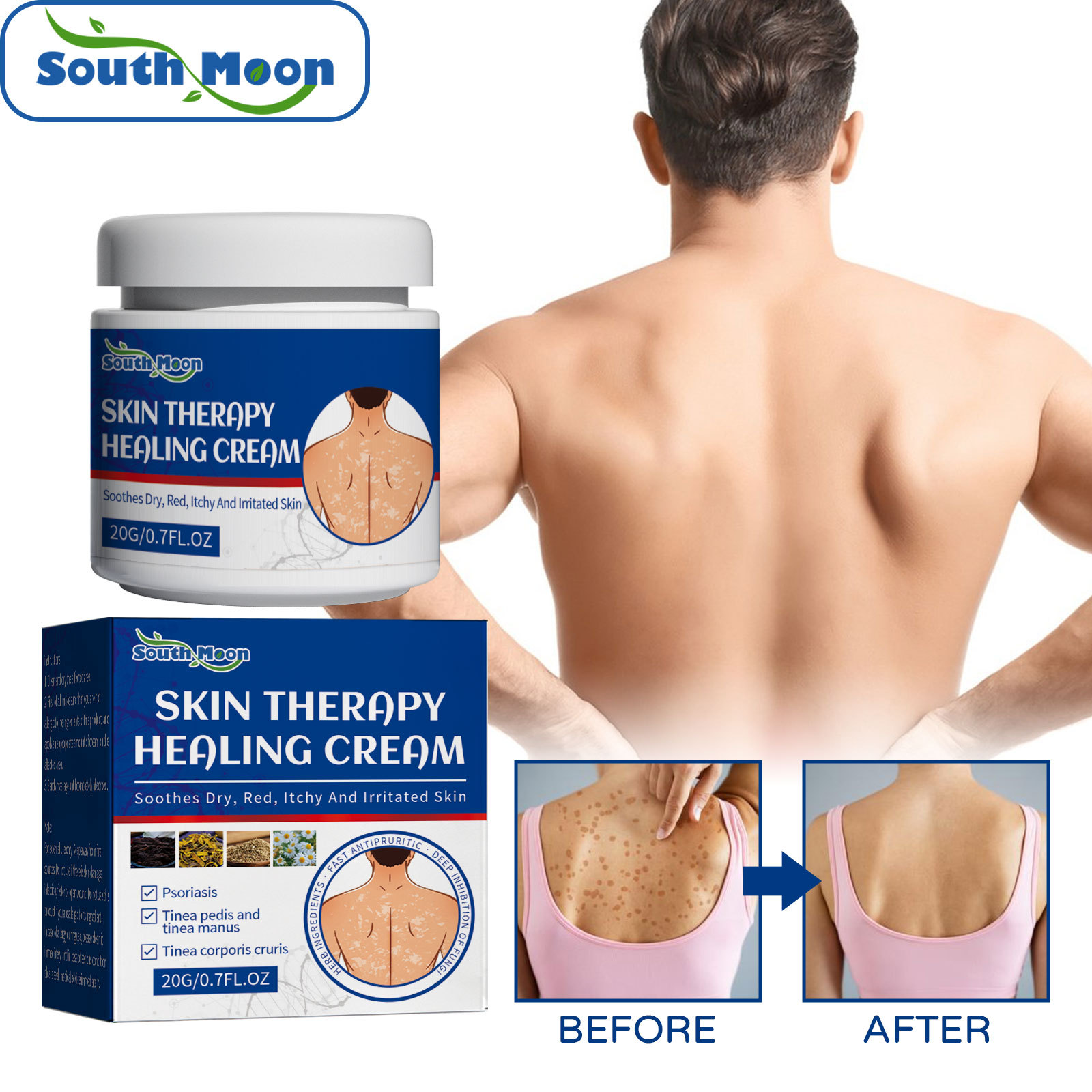 Skin Repair cream antipruritic puncture loss redness and itching in the body repair original skin body skin care tools 20g