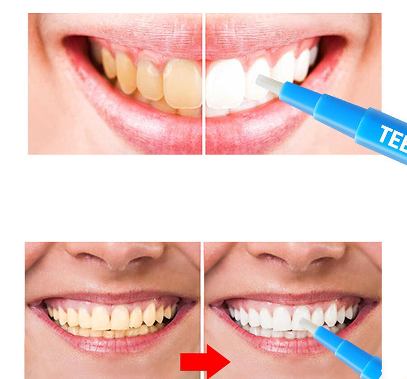 [HCM]Bút Tẩy Trắng Răng LANBENA - Mẫu mới