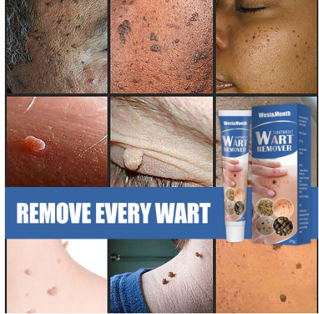 {ĐÁNH BẬT} Mụn Cóc, Mụn Thịt Remove Every Warts