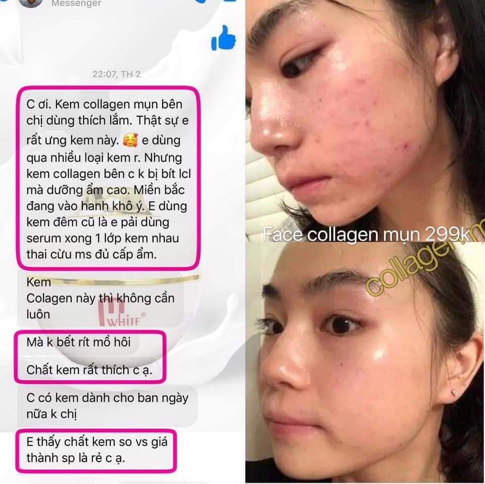 [HCM]Kem face collagen Mwhite D.O.PRO dành cho da mụn