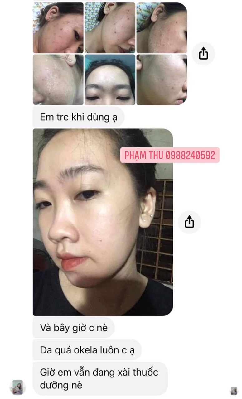 [HCM]Thuoc bac tái tạo da 2021 [100ML tặng kèm lọ giảm đỏ]