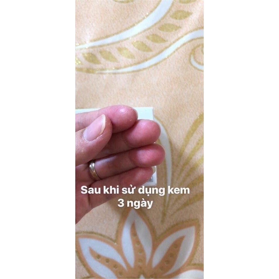 Kem á sừng Keratinamin