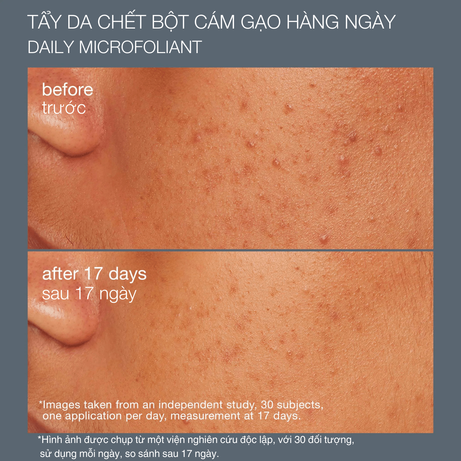 (Bản giới hạn mùa lễ hội) Bộ giải pháp làm sạch & toả sáng (3 sản phẩm kích cỡ fullsize)