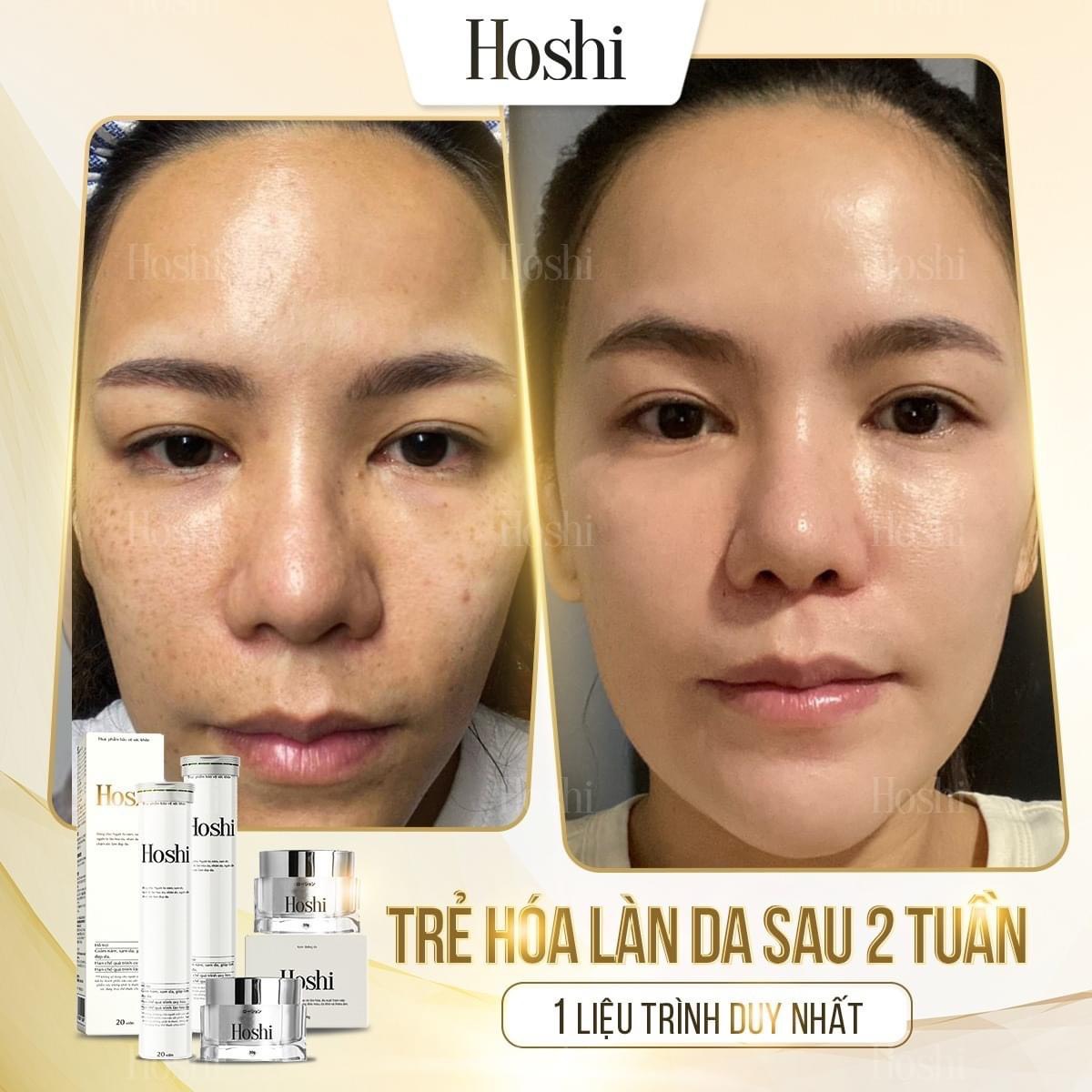 Bộ mờ nám, trắng da Hoshi Nhật Bản