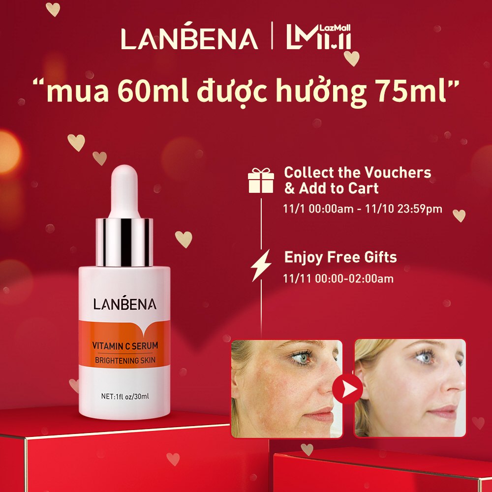 LANBENA Kem D ng Da Ch a Vitamin C L m M V t Th m Ch ng L o Ho Nu i lanbena-kem-d-ng-da-ch-a-vitamin-c-l-m-m-v-t-th-m-ch-ng-l-o-ho-nu-i