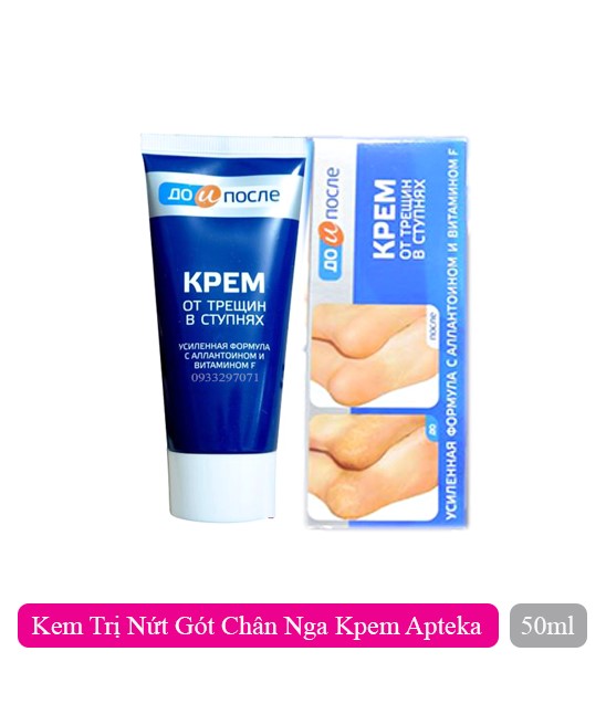 Kem dưỡng nứt nẻ gót chân KPEM 50ml