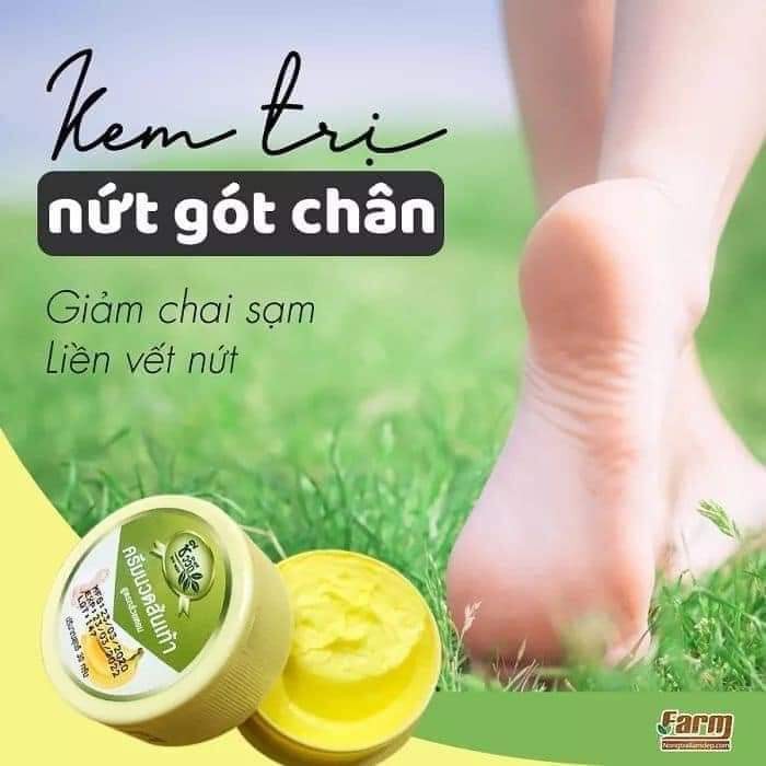 [HCM]KEM THOA NỨT GÓT CHÂN 30gr- HÀNG THÁI LAN