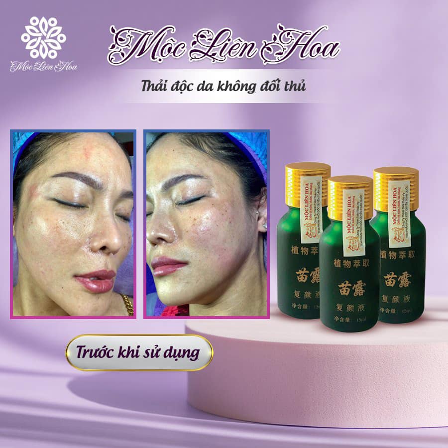 Serum đào thải sắc tố Mộc Liên Hoa