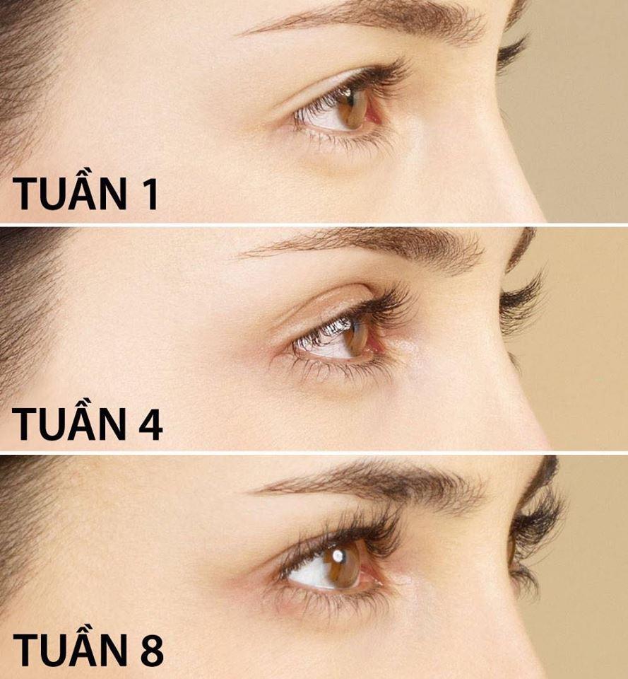 Thuốc mọc lông mày, dài mi Lumigan - Mỹ