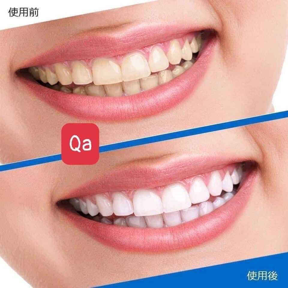 Miếng dán trắng răng 3D White