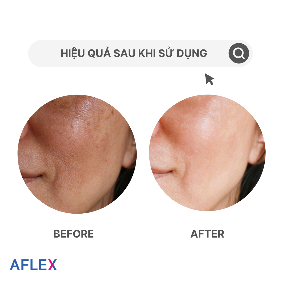 Kem dưỡng trắng da, mờ thâm nám BOTANICSENS Nutritive Erasing Cream