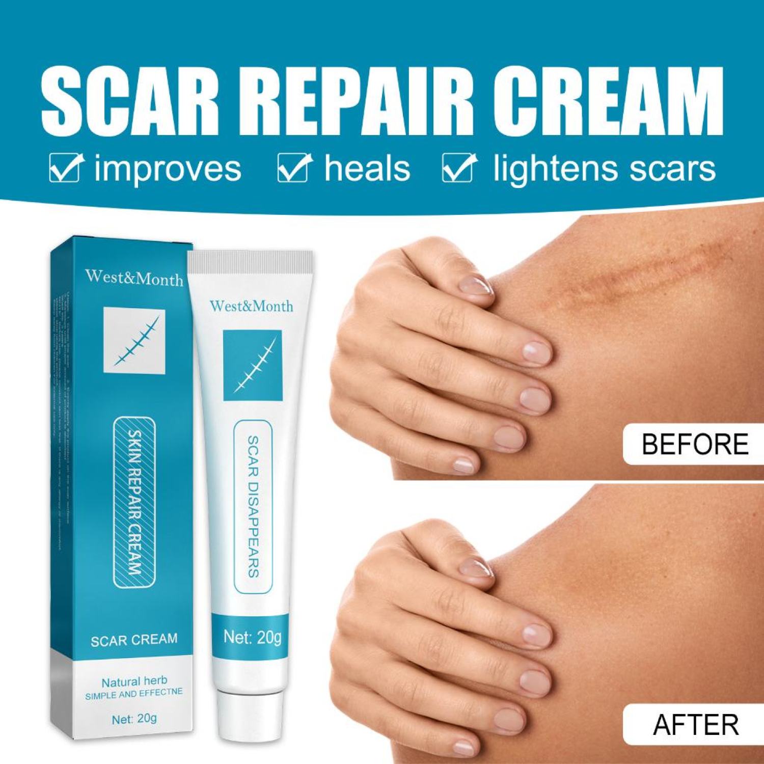 Kem tɾị Sẹo Scar Cream 20g