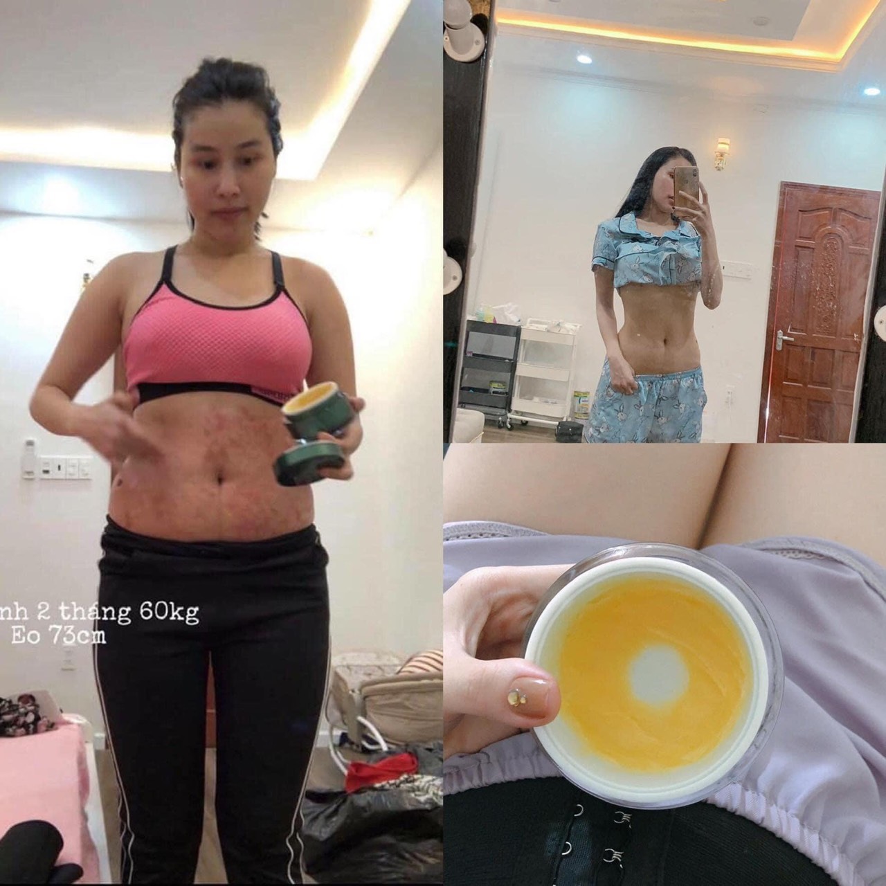 KEM TAN MỠ COLAGEN SLIMMING DAY