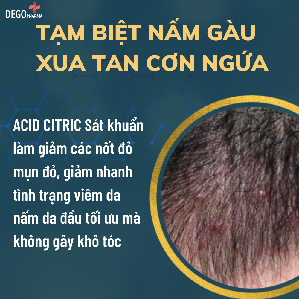 Hơn 46 ảnh về thuốc chống rụng tóc cho nam  NEC