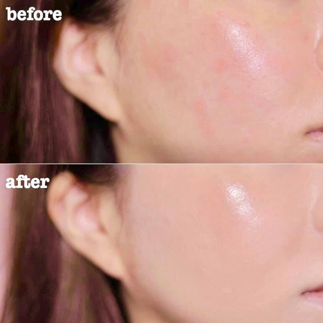 Mặt nạ Mask B5 Yuejin Repair Control