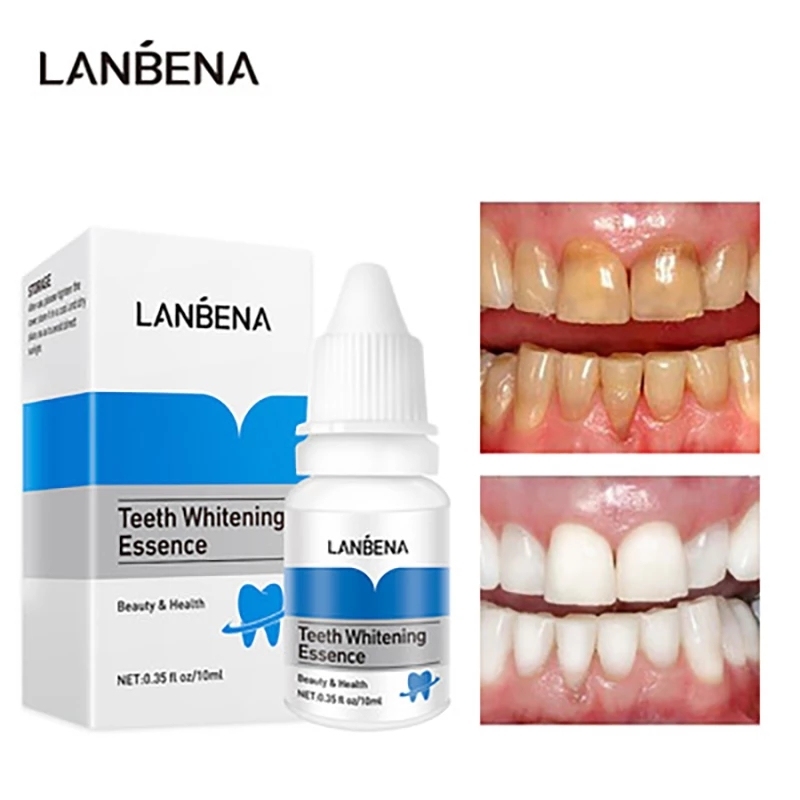Tinh Chất Tẩy Trắng Răng Làm Sạch Răng Miệng Khử Mùi Hôi Miệng Oral Teeth Whitening Essence LANBENA 10ml