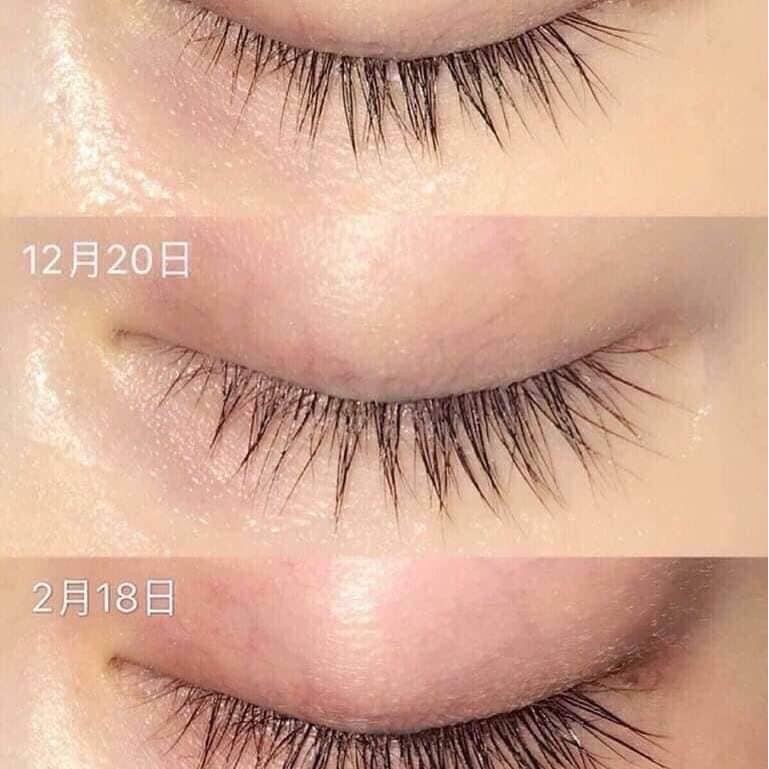 Tinh Chất Dưỡng Dài Mi DHC Eyelash Tonic Nhật Bản 6.5ml