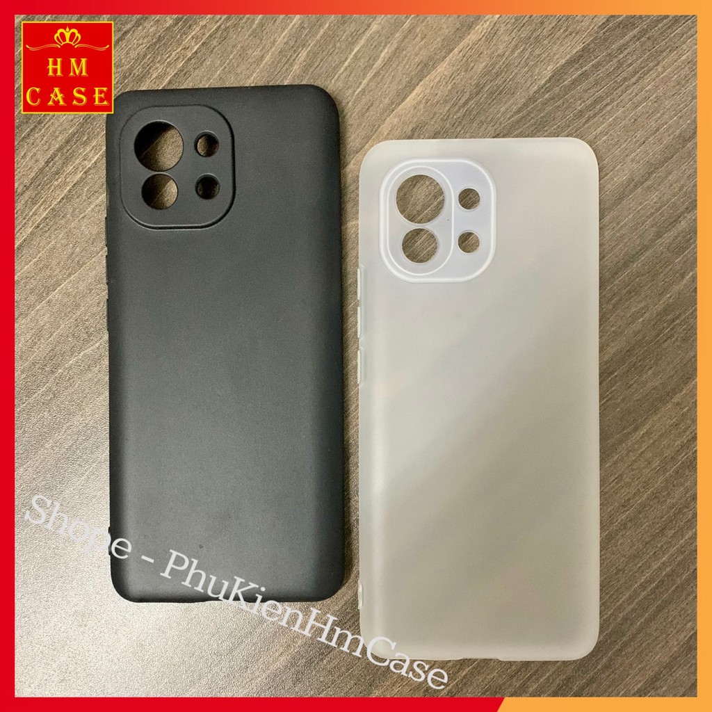 Ốp lưng tpu xiaomi mi 11 / mi 10s / mi 11 lite ne / mi 11 pro / mi 11 ultra, mặt lưng nhám chống vân tay