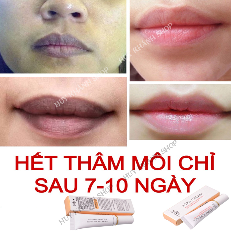 Kem tái tạo hồng môi khử thâm mềm mịn hồng hào