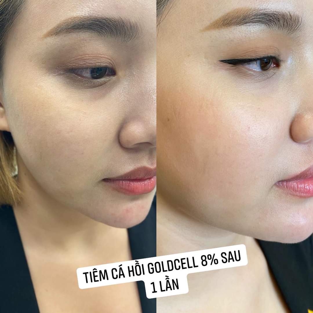 CĂNG BÓNG GOLD CELL 8% HÀN QUỐC CHÍNH HÃNG