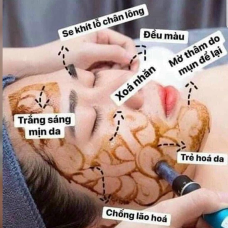 Cấy Hồng Sâm Gogo Hàn Quốc Cao Cấp