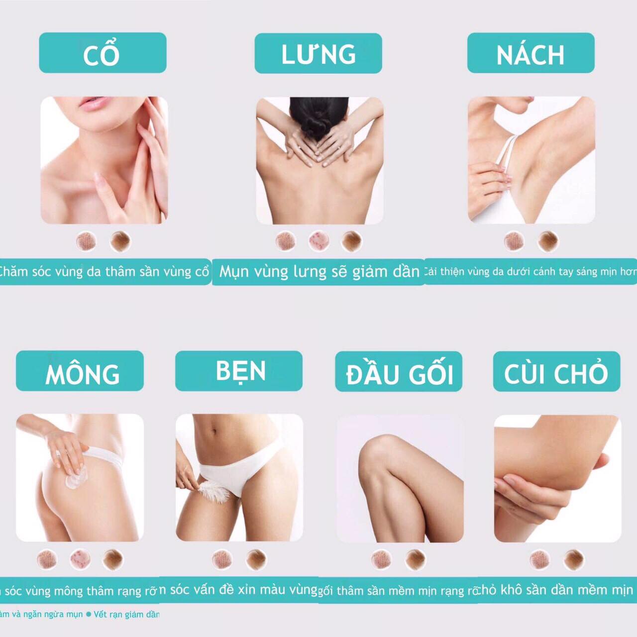 [HCM]Kem bôi thâm body NAKIZ LIVELY BUTT - Combo 3 tuýp