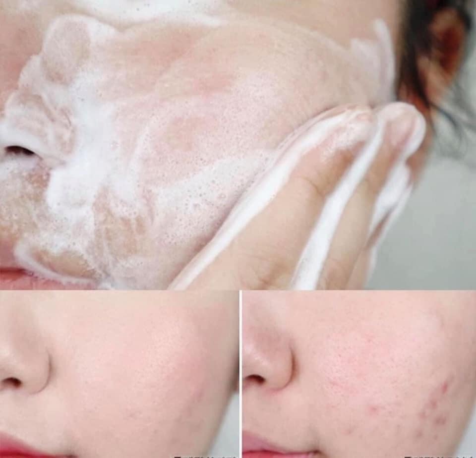Sữa Rữa Mặt Skin1004 Madagascar Centella Ampoule Foam 125ml