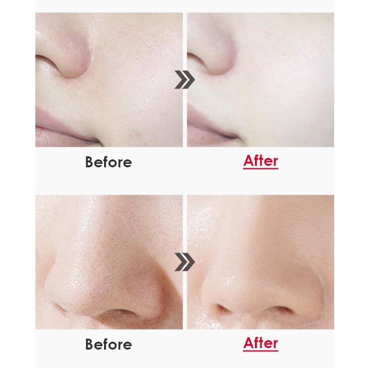 Mặt nạ Compliment Green Mask