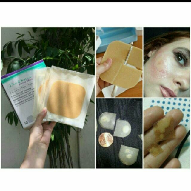 [CHÍNH HÃNG] Miếng dán mụn Duoderm Extrathin(Hộp 10 miếng)