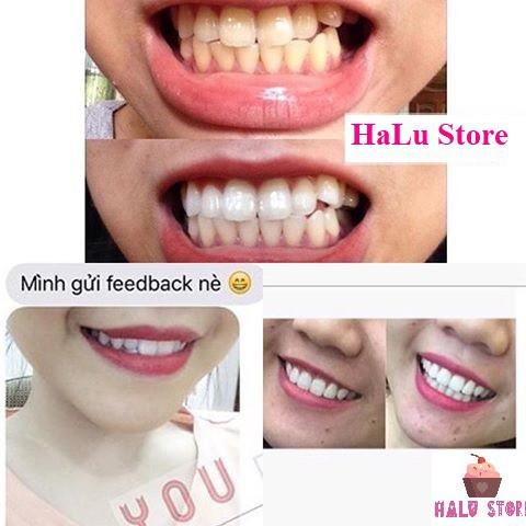 [HCM]Miếng dán trắng răng Crest 3D White Whitestrips loại Glamorous - Mỹ