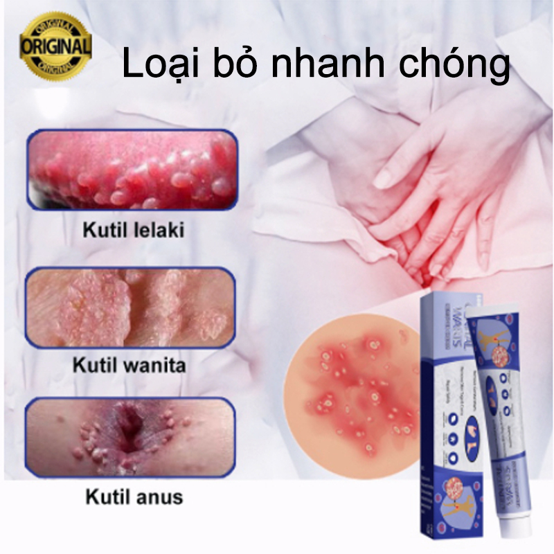 kem bôi rụng hết sạch mụn thịt thừa, mụn cóc, mụn nốt duồi，Kem bôi rụng hết mụn cóc,mụn thịt, mụn cơm, mụn ruồi, nám tàn nhang bay hết nhanh trong vong một nốt nhạc lọ 20g  chính hãng, loại bỏ mụn trâu gây khó chịu.