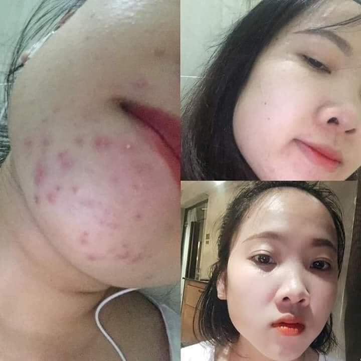 [HCM]Serum Hoa Anh Đào