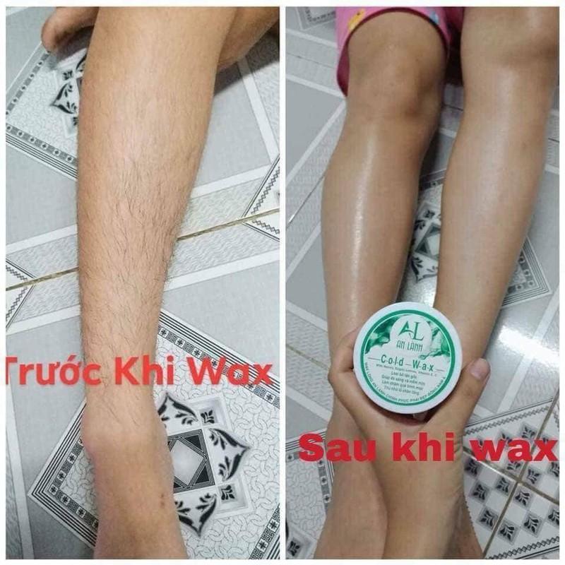 Combo triệt lông An Lành