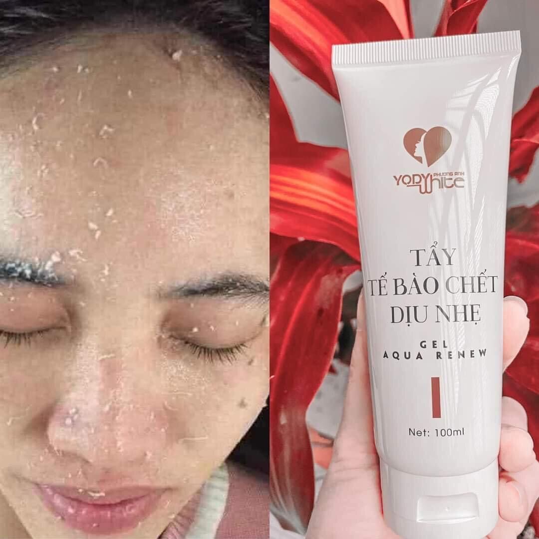 TẨY DA CHẾT DỊU NHẸ PHƯƠNG ANH