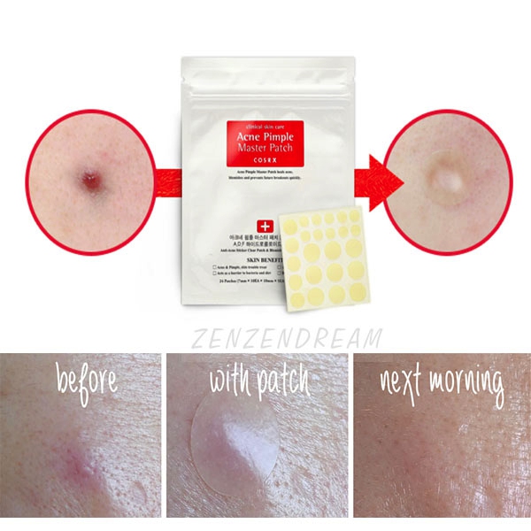 Miếng dán mụn Cosrx Acne Pimple Master Patch 24 miếng và Cosrx The Clear Pit Master Patch 18 miếng.
