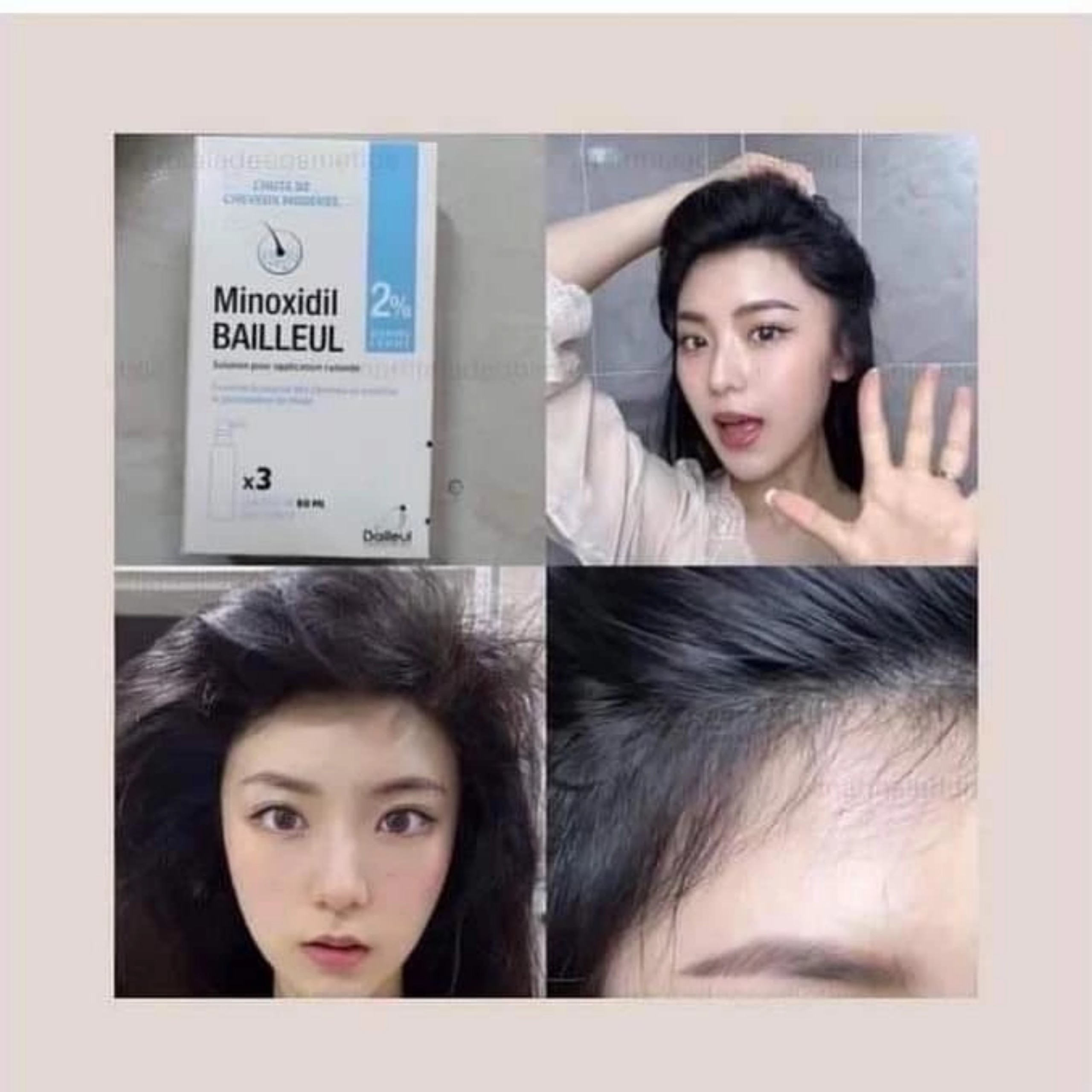 Xịt Mọc Tóc Minoxidil BAILLEUL 2%