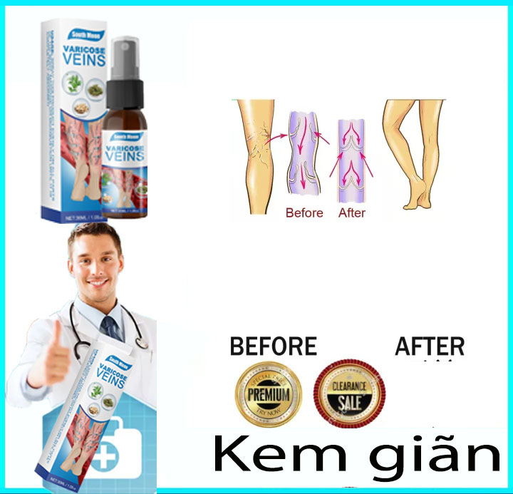 Kem Giãn tĩnh mạch trị giãn tĩnh mạch，giúp lưu thông tĩnh mạch phục hồi hiệu quả các mạch